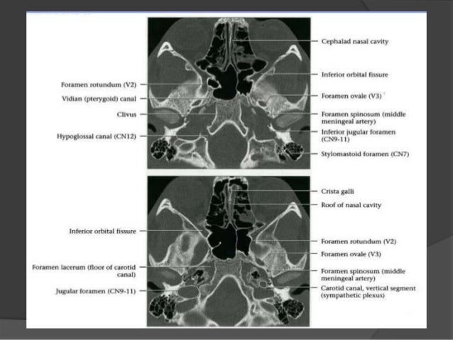 Cranial Nerves: Anatomy, Pathology, Imaging: Anatomy, Pathology, Imaging